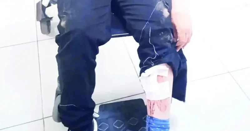 İstanbul da başıboş köpekler 10 yaşındaki Cemal e okul çıkışı dehşeti yaşattı!