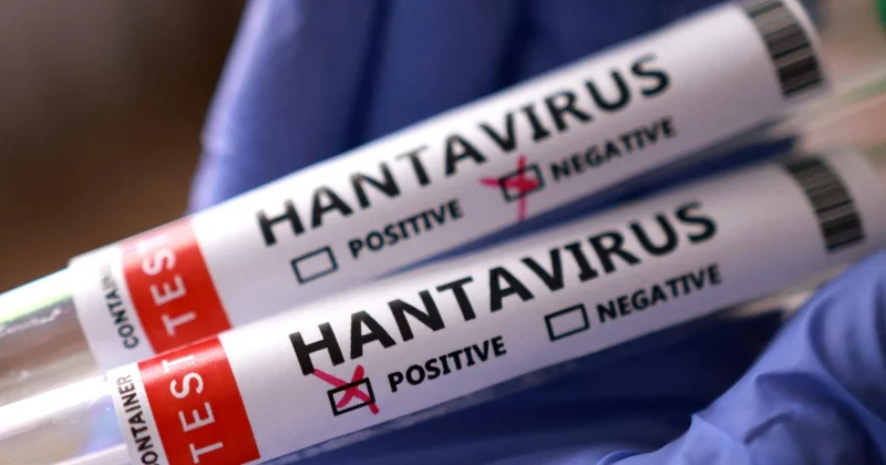 Yolcu gemisi MV Hondius ta 5 hantavirüs vakası doğrulandı