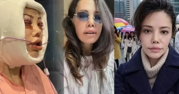 Kore de yüz nakli sonrası ölüm dilekleriyle karşılaştı: Didem Ceran isyan etti