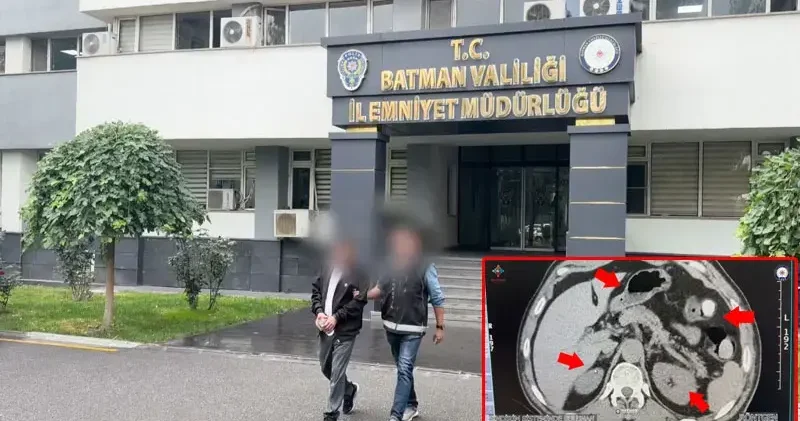 Midesinden uyuşturucu çıkan şüpheli tutuklandı
