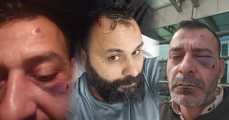 SON DAKİKA… Sosyal medya fenomeni Adem Ocaktan öldüresiye darp edildi! Dehşet anları kamerada: Kafasına 17 dikiş atıldı!