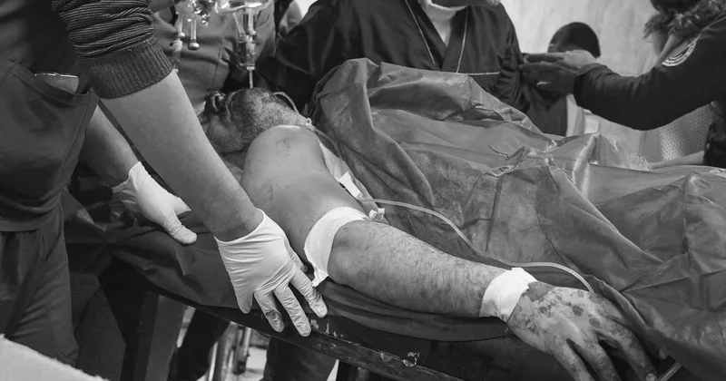 Terör örgütü YPG nin Halep teki saldırılarında 7 kişi öldü, 52 kişi yaralandı