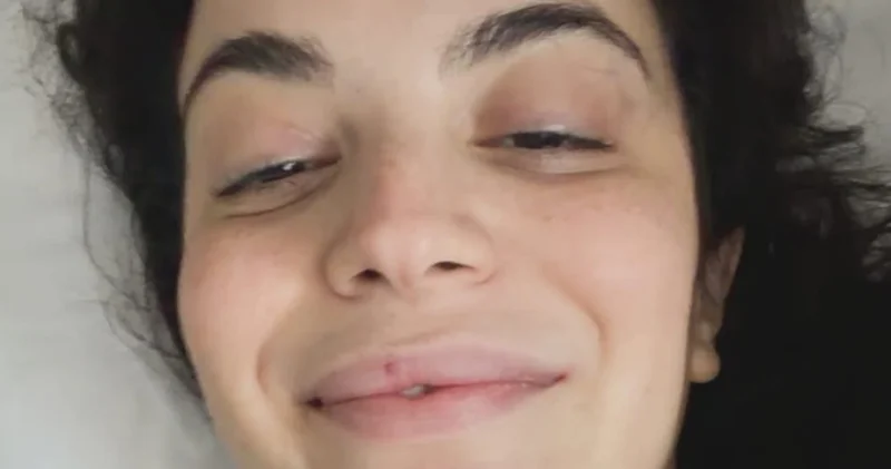 Yedinci kez ameliyat olan Aslı Bekiroğlu ndan sağlık durumu hakkında açıklama