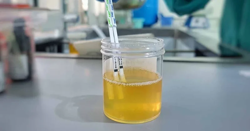 Bu 3 belirtiden 2 si varsa derhal doktora gidin Sözcü Gazetesi