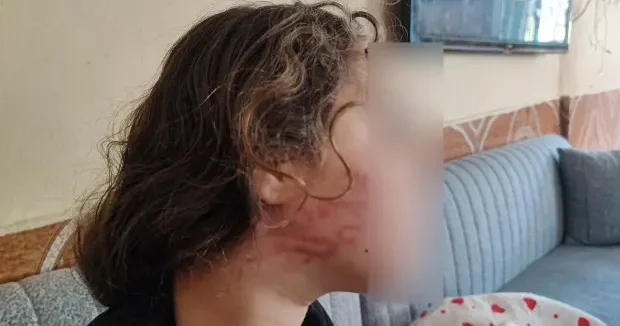 Adana haberleri Adana da 11 yaşındaki çocuğa darp iddiası 08 Mayıs 2026