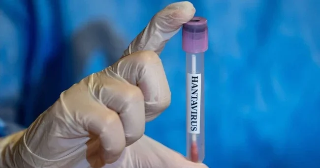 Türkiye de hantavirüs var mı? Sağlık Bakanlığı ndan açıklama geldi