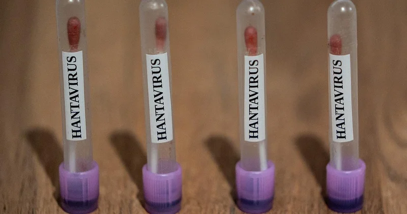ABC: ABD, hantavirüs vakalarını 3. seviye acil durum koduyla takibe aldı