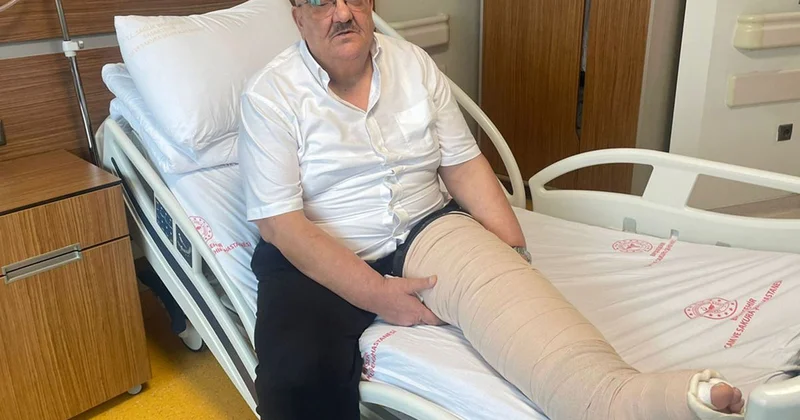 İstanbul da fil hastasının 2 katına çıkan bacağındaki şişlik tedaviyle geriledi