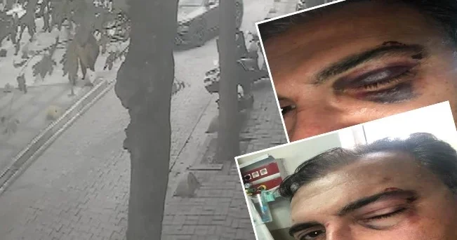 Sokakta kedi besleyen iş insanına güpegündüz saldırı