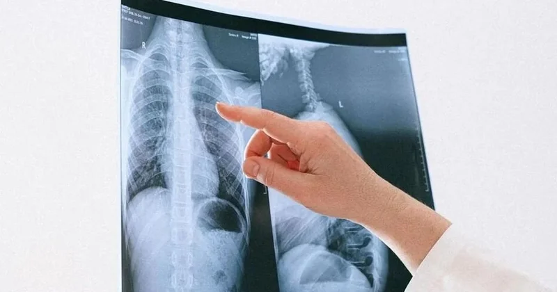 Her yıl milyonlarca insan hayatını kaybediyor! Sebebi ise belli Sözcü Gazetesi