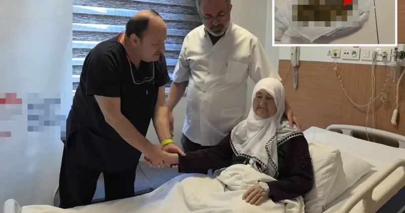 Safra Kesesinden 213 Taş Çıkarıldı