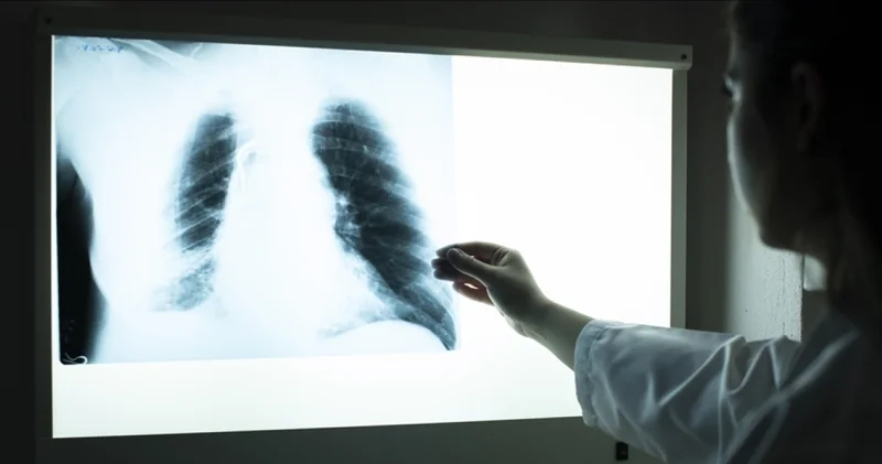 Tütünle mücadelede hedef 1 milyon başvuru Sağlık Haberleri