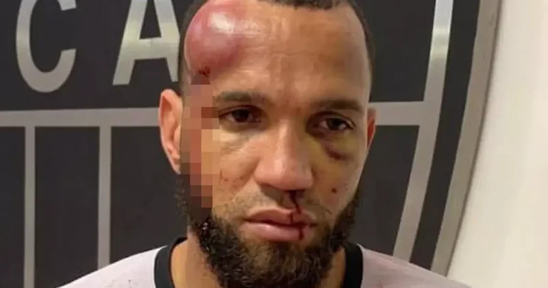 23 kırmızı kartın çıktığı futbol savaşında kaleci tanınmayacak hale geldi