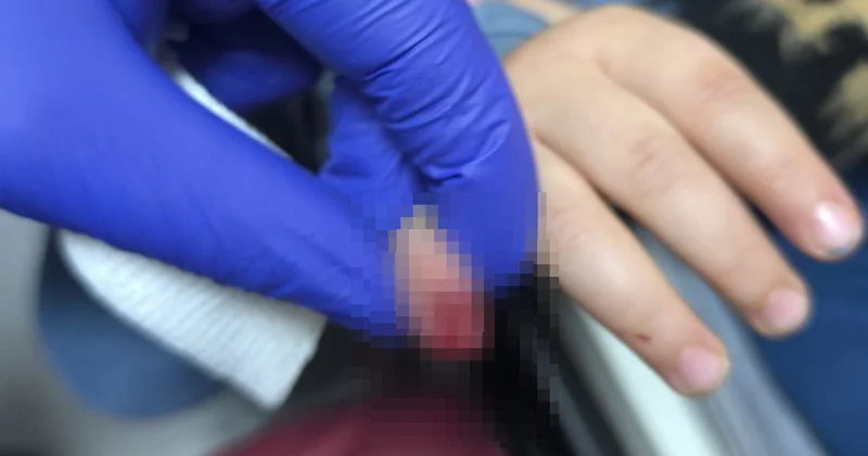 Alışveriş Merdiveninde Korkunç Kaza