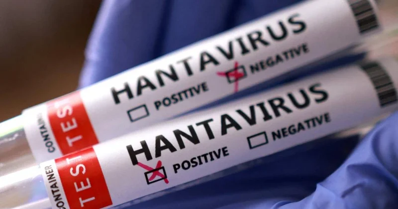 DSÖ hantavirüs görüşünü açıkladı! Pandemi senaryoları gündemdeydi