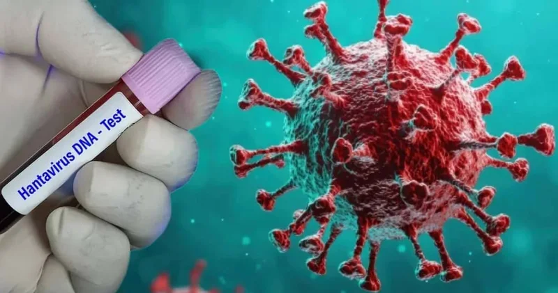 Hantavirüs gemisinde korku büyüyor! 17 Amerikalıyı tahliye etmek için özel uçak