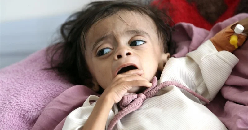 BM’den Yemen’de insani kriz uyarısı