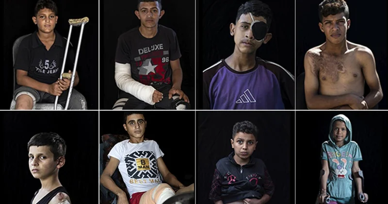 Gazze de 5 bini aşkın çocuk ampute edildi