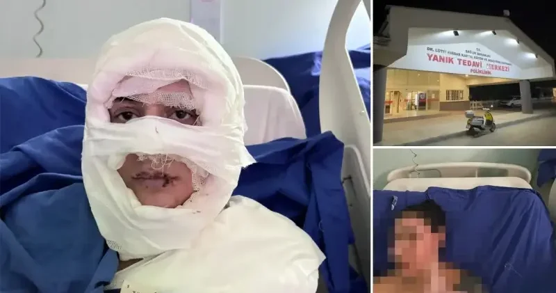 Kadıköy de bir kadın ateşe verildi: Kendimi güvende hissetmiyorum İstanbul Haberleri