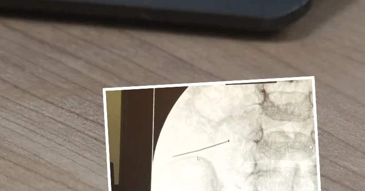 2 yaşındaki çocuk ağrıyla kıvranıyordu... Hastaneye götürülünce bağırsağından çıktı Ölümle sonuçlanabilirdi