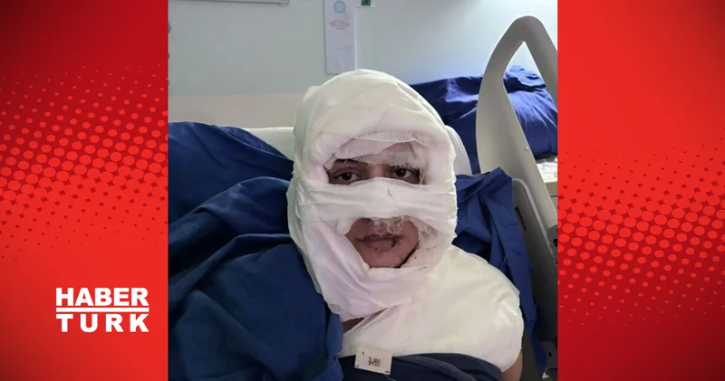 Kadıköy de genç kadını kolonyayla yakarak yaraladığı öne sürülen şüpheli tutuklandı Son dakika haberleri