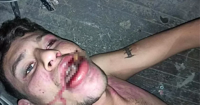 Antalya da İşkence Davasında Ceza Kararı