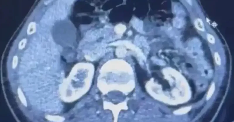 Üç İranlı röntgene girince yakayı ele verdi