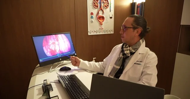 Prostata holep ile kesin çözüm: 400 grama kadar prostat güvenle alınabiliyor Samsun Haberleri