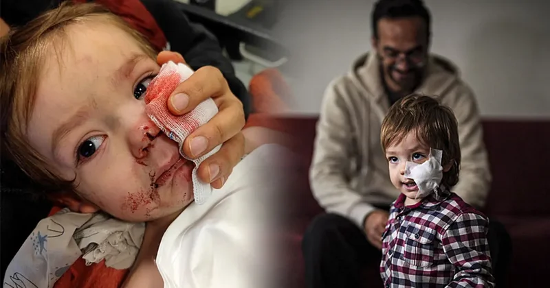 SON DAKİKA… Ankara’da komşusunun pitbull cinsi köpeğinin saldırısına uğramıştı: 1,5 yaşındaki Efe Öztürk’ten haber var!