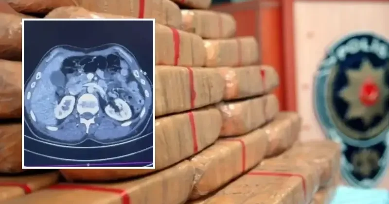 Ülkeye midelerinde uyuşturucu getiren şahıslar yakalandı Politika Haberleri