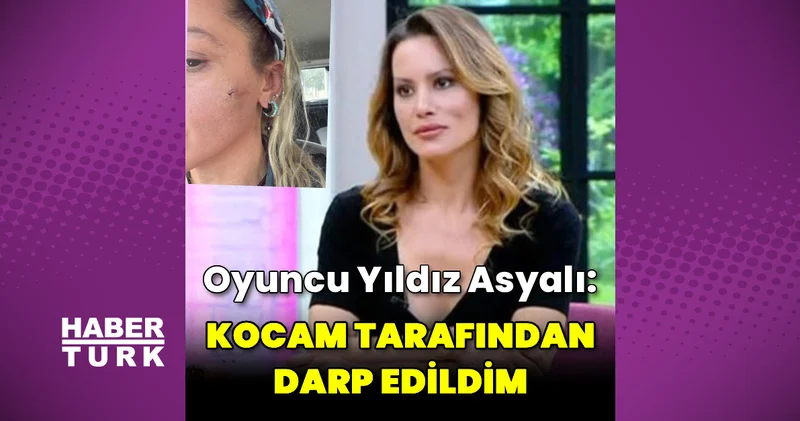 Yıldız Asyalı: Kocam tarafından darp edildim Magazin haberleri