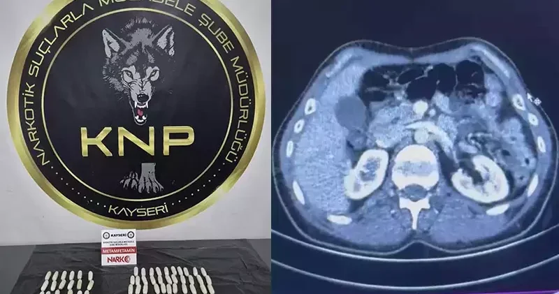 İranlı şüphelilerin midelerinde uyuşturucu tespit edildi; 3 gözaltı