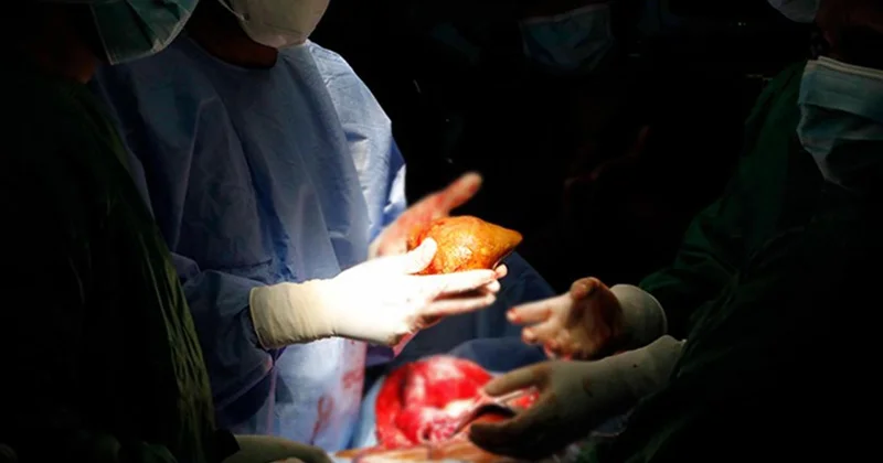 Kuduzlu böbrek nakli yapıldı, hayatını kaybetti