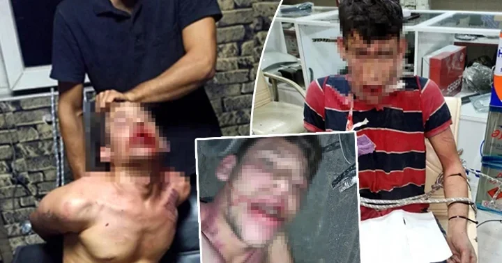 3 gün süren kâbus: Hamam böceği yedirildi, darbedildi, dişleri kırıldı! İşkence davasında karar