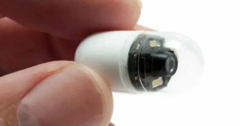 Kolonoskopi tarih oluyor! Akıllı hap sahnede: 20 dakikada rapor verecek