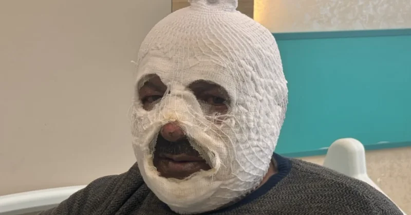 Kalorifer kazanını yakmak istedi canını zor kurtardı Sözcü Gazetesi