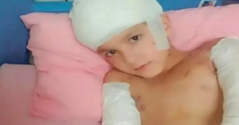 Sokak köpeği saldırısı davasında emsal karar: 5 milyon lira tazminat