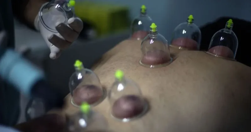 Kamu bütçesinden hacamata pay! CHP li Şahbaz düzenlemeye tepki gösterdi: Elveda modern tıp, yaşasın sülük, ot...