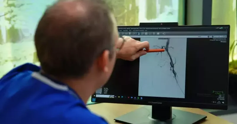 Uzman isim dikkat çekti: 2050 de 3 milyon kişi uzvunu kaybedebilir