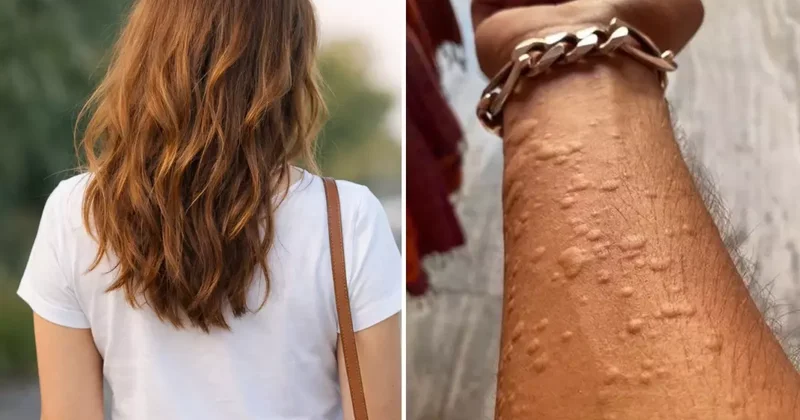 Erkek arkadaşımı ziyaret ettim diyen kadın, bu fotoğrafı paylaşıp yardım istedi