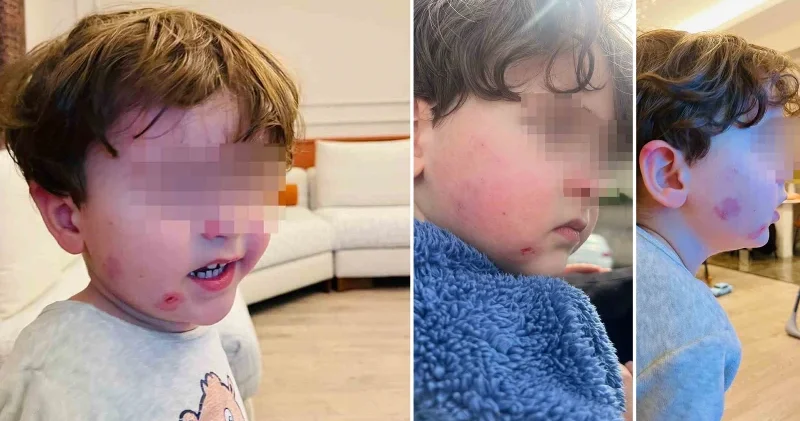 Kreşte skandal: Sağlıklı bıraktığı çocuğunu darp edilmiş halde aldı Bursa Haberleri