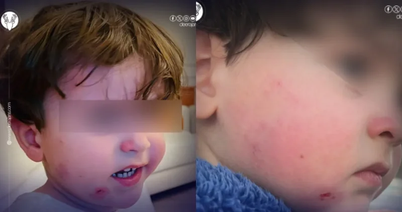 Özel kreşte 2.5 yaşındaki çocuğa darp iddiaları bir kenti salladı!