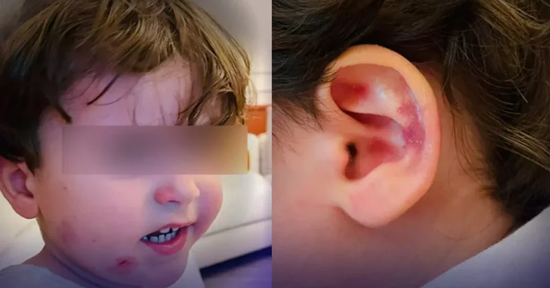 Gemlik’te özel kreşte skandal! 2,5 yaşındaki çocuk darp edildi, ailesi görünce şoke oldu