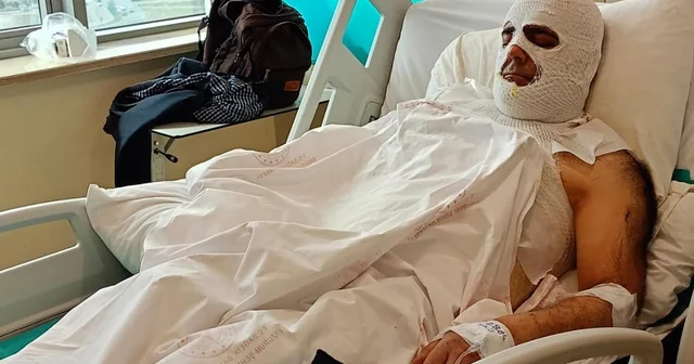 Yüksek gerilim akımına kapılan işçi 42 gündür hastanede Erzurum Haberleri
