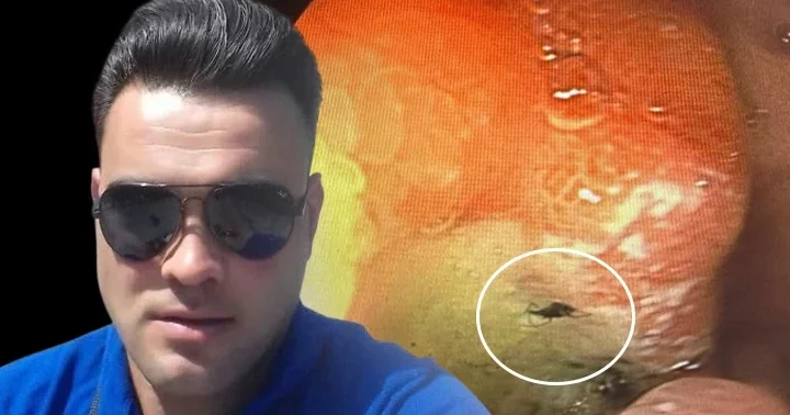 Mide ağrısı şikayetiyle doktora gitti, hayatının şokunu yaşadı! Sebebi böcek çıktı... Aklımıza gelmeyen şey başımıza geldi