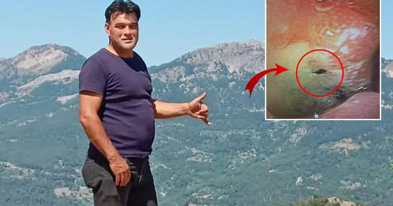 Çiftçinin midesinden böcek çıktı
