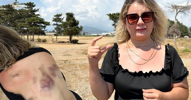 Eski sevgilisi tam 30 yerinden bıçakladı! Talihsiz kadın dehşeti anlattı: Bıçak sırtımda kırılmasa…