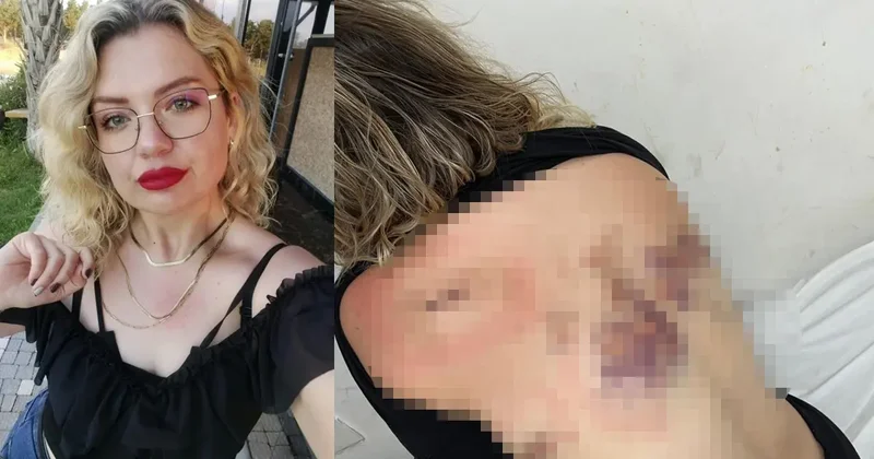 Sırtında kırılan bıçakla hayatta kaldı! Antalya da eski sevgili dehşeti