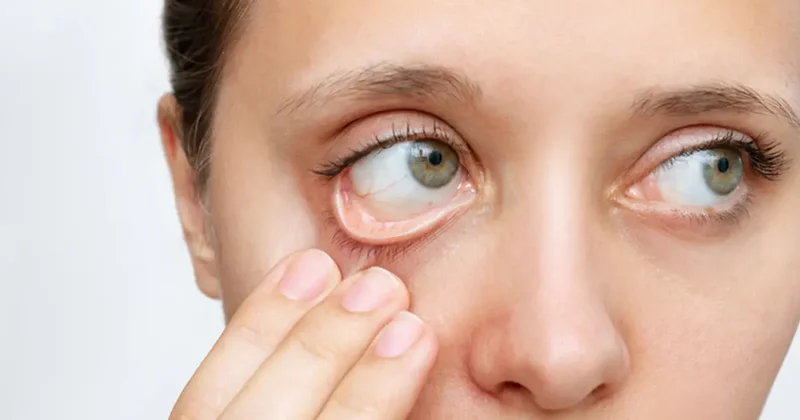 Vücudunuz bu vitamini üretemiyor! Eksikliği bakın nelere yol açıyor