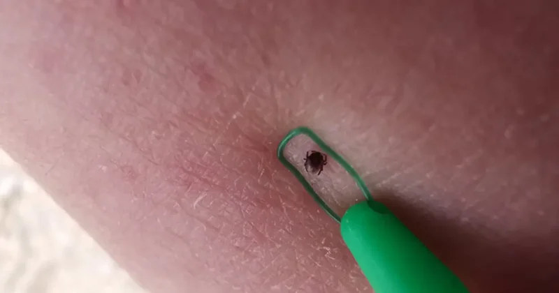 Kenelerden bulaşan yeni virüs ortaya çıktı! 7 kişi hayatını kaybetti